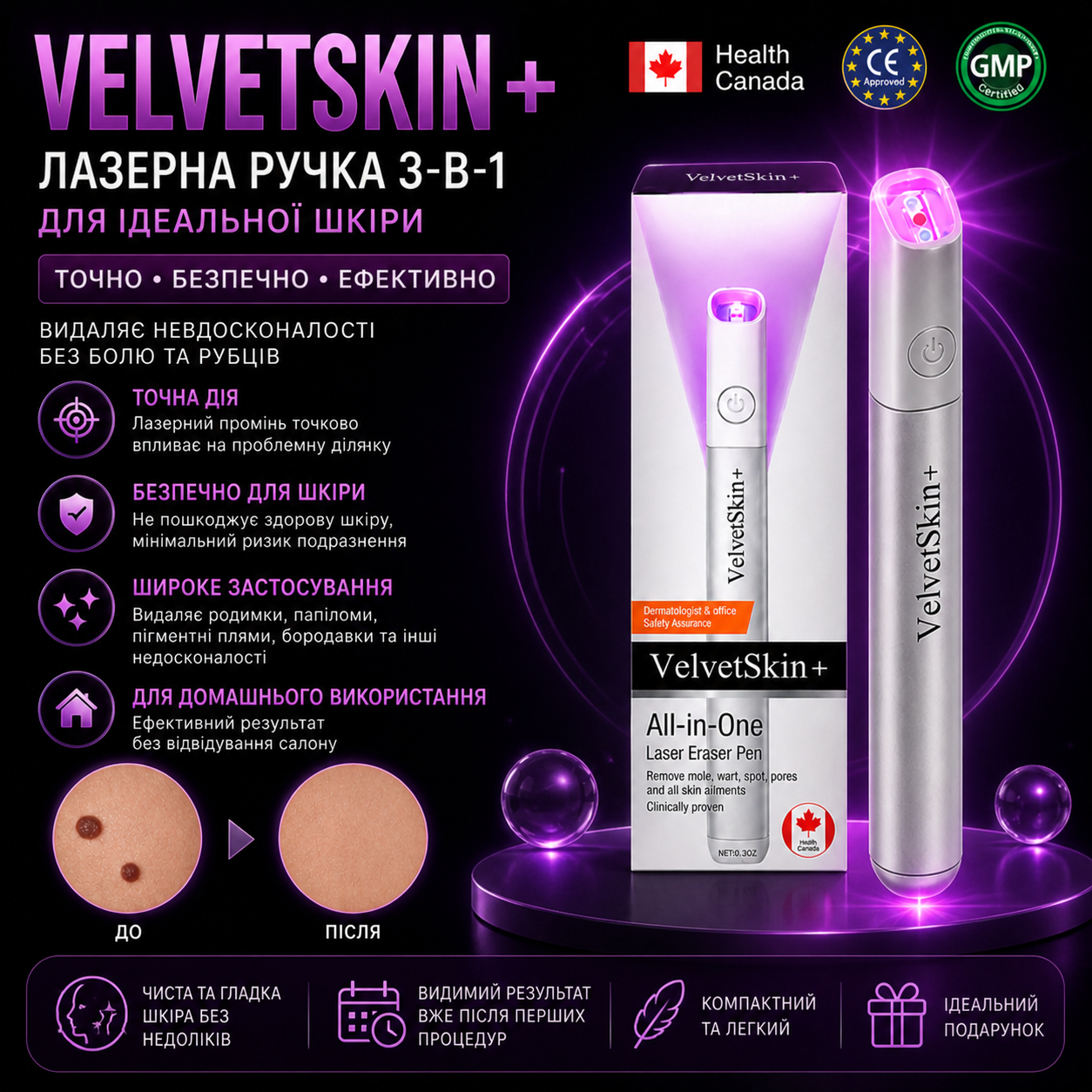 Лазерна ручка для видалення родимок та недосконалостей шкіри VelvetSkin+