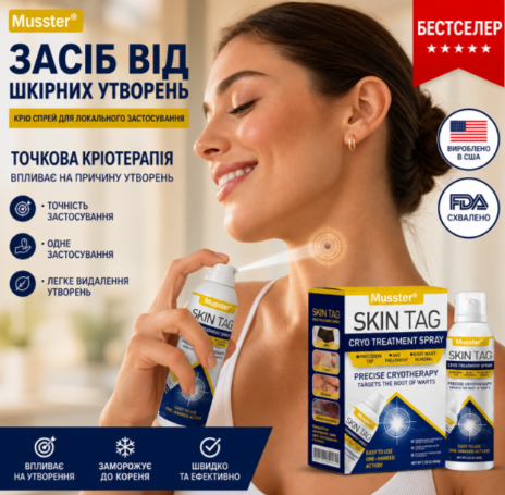 Cпрей для кріотерапії